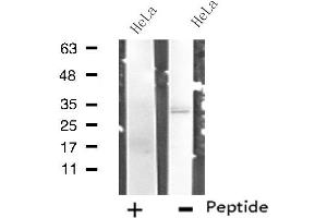 Western blot analysis of extracts from HeLa cells, using RNF144B antibody. (RNF144B anticorps  (Internal Region))