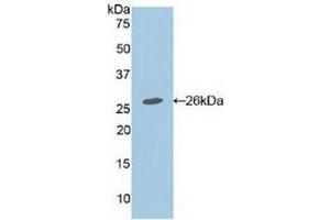 Detection of Recombinant APC, Mouse using Polyclonal Antibody to Adenomatosis Polyposis Coli Protein (APC) (APC anticorps  (AA 2636-2845))