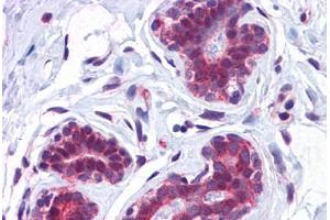 Human Breast: Formalin-Fixed, Paraffin-Embedded (FFPE) (CCDC106 anticorps  (C-Term))