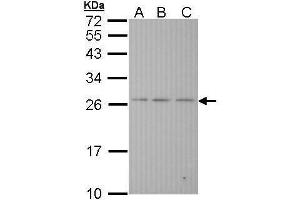 WB Image Sample (30 ug of whole cell lysate) A: Hela B: Hep G2 , C: Molt-4 , 12% SDS PAGE antibody diluted at 1:1000 (BAK1 anticorps  (N-Term))