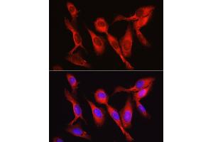 Immunofluorescence analysis of U2OS cells using Vinculin antibody (ABIN6128911, ABIN6150070, ABIN6150071 and ABIN6218474) at dilution of 1:150. (Vinculin anticorps  (AA 767-1066))