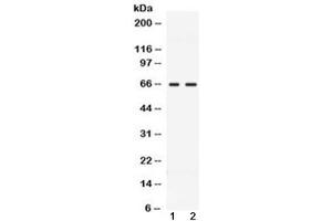 Western blot testing of 1) rat testis and 2) human MCF7 lysate with CCDC6 antibody at 0. (CCDC6 anticorps  (AA 156-198))
