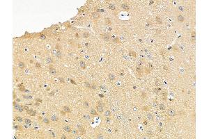 ABIN6255313 and ABIN6267193 at 1/100 staining Rat brain tissue by IHC-P.