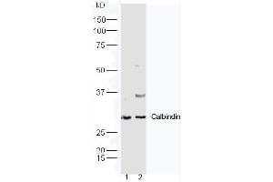 Lane1: Mouse kidney lysate, Lane2: Mouse brain lysate probed with Rabbit Anti-Calbindin Polyclonal Antibody, Unconjugated (ABIN2559729) at 1:300 in 4˚C. (CALB1 anticorps  (AA 41-150))