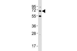 Western blot testing of p62 antibody at 1:500 dilution + HeLa lysate