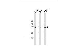 All lanes : Anti-RBCK1 (UBCE7IP3) Antibody at 1:2000 dilution Lane 1: Jurkat whole cell lysate Lane 2: 293 whole cell lysate Lane 3:  whole cell lysate Lysates/proteins at 20 μg per lane.
