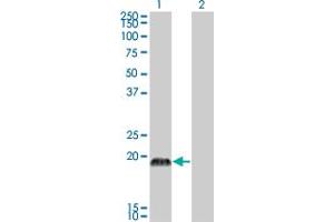 Western Blot analysis of CSRP3 expression in transfected 293T cell line by CSRP3 monoclonal antibody (M03), clone 6D2.