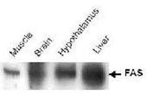 Western blot analysis of Fasn in tissue lysates (brain, hypothalmus, and liver and muscle) using Fasn polyclonal antibody . (Fatty Acid Synthase anticorps)