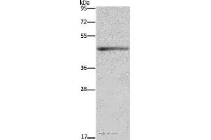 Western blot analysis of Mouse heart tissue, using IL5RA Polyclonal Antibody at dilution of 1:650 (IL5RA anticorps)