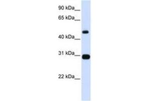 Image no. 1 for anti-Proteasome (Prosome, Macropain) 26S Subunit, ATPase, 3 (PSMC3) (AA 101-134) antibody (ABIN6741431) (PSMC3 anticorps  (AA 101-134))