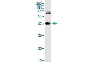 TREX1 MaxPab rabbit polyclonal antibody.