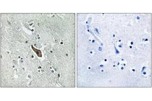 Immunohistochemistry analysis of paraffin-embedded human brain tissue, using ROBO2 Antibody.