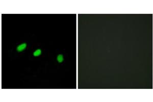 Immunofluorescence analysis of HeLa cells, using TRA-2 alpha antibody. (TRA2A anticorps  (C-Term))