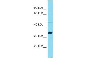 Western Blotting (WB) image for anti-Suppressor of Ty 7 Like (SUPT7L) (Middle Region) antibody (ABIN2790711) (SUPT7L anticorps  (Middle Region))