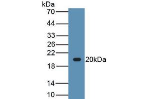 Detection of Recombinant LEP, Canine using Polyclonal Antibody to Leptin (LEP)
