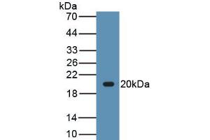 Detection of Recombinant LEP, Canine using Polyclonal Antibody to Leptin (LEP) (Leptin anticorps  (AA 22-167))