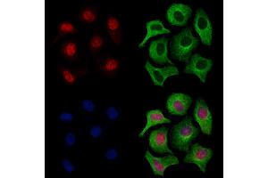 ABIN7094692 and ABIN7098743 staining Hela cells by IF/ICC. (LMX1A anticorps  (Internal Region))