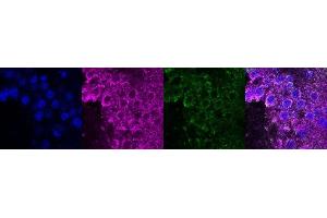 Immunohistochemistry (IHC) image for anti-Coiled-Coil Domain Containing 153 (CCDC153) antibody (ABIN7456205) (CCDC153 anticorps)