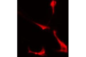 ABIN6274360 staining COLO205 cells by IF/ICC. (PSMD2 anticorps  (Internal Region))