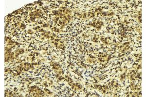 anti-Speckle-Type POZ Protein (SPOP-B) (Internal Region) antibody