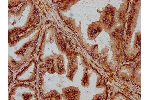 IHC image of ABIN7156271 diluted at 1:200 and staining in paraffin-embedded human prostate tissue performed on a Leica BondTM system.