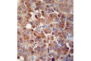 anti-Chordin-Like 1 (CHRDL1) (AA 5-35), (N-Term) antibody