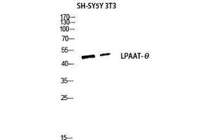 Western Blot (WB) analysis of SH-SY5Y 3T3 lysis using LPAAT-theta antibody. (AGPAT9 anticorps  (C-Term))