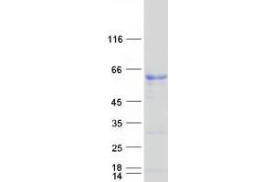 Validation with Western Blot