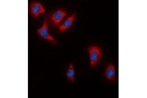 Immunofluorescent analysis of c-RAF staining in HeLa cells. (RAF1 anticorps  (C-Term))
