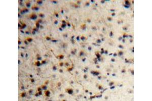 IHC-P analysis of Brain tissue, with DAB staining. (KISS1 anticorps  (AA 1-126))
