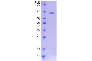 SDS-PAGE analysis of Human CTL1 Protein. (SLC44A1 Protéine)