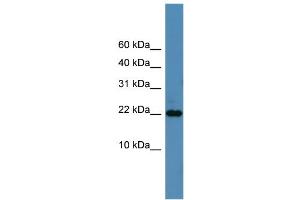 WB Suggested Anti-SFRS12IP1 Antibody Titration: 0. (SFRS12IP1 anticorps  (N-Term))