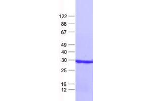 Validation with Western Blot