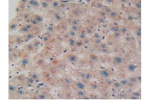 Detection of COIL in Human Liver Tissue using Polyclonal Antibody to Coilin (COIL)