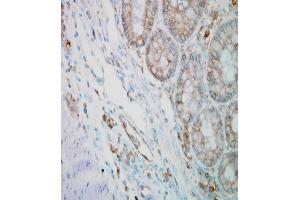 CalnexinCT, mouse colitis, Amplifier