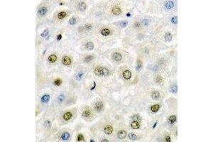 Immunohistochemical analysis of SSRP1 staining in mouse liver formalin fixed paraffin embedded tissue section.