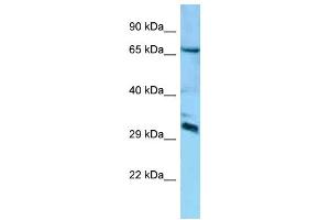 Western Blotting (WB) image for anti-DCN1, Defective in Cullin Neddylation 1, Domain Containing 4 (DCUN1D4) (Middle Region) antibody (ABIN2788475) (DCUN1D4 anticorps  (Middle Region))