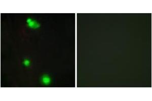 Immunofluorescence analysis of MCF7 cells, using SFRS3 Antibody.