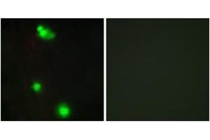 Immunofluorescence analysis of MCF7 cells, using SFRS3 Antibody. (SRSF3 anticorps  (AA 111-160))