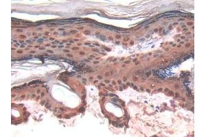 DAB staining on IHC-P; Samples: Rat Skin Tissue (LGALS7 anticorps  (AA 1-128))