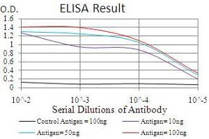 Black line: Control Antigen (100 ng), Purple line: Antigen(10 ng), Blue line: Antigen (50 ng), Red line: Antigen (100 ng),