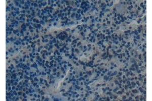 Detection of RANk in Rat Spleen Tissue using Polyclonal Antibody to Receptor Activator Of Nuclear Factor Kappa B (RANk)