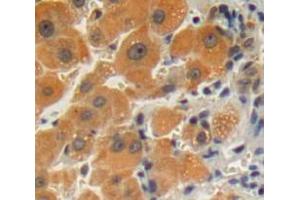 Used in DAB staining on fromalin fixed paraffin-embedded liver tissue (GPLD1 anticorps  (AA 496-840))