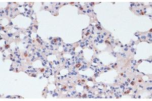 Immunohistochemistry of paraffin-embedded Mouse lung using LYZ Polyclonal Antibody at dilution of 1:100 (40x lens). (LYZ anticorps)