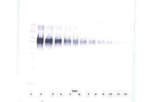 Image no. 2 for anti-Intercellular Adhesion Molecule 1 (ICAM1) antibody (ABIN465661) (ICAM1 anticorps)
