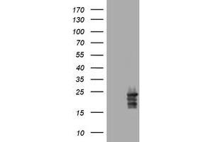 Image no. 4 for anti-Visinin-Like 1 (VSNL1) (AA 2-191) antibody (ABIN1491124) (VSNL1 anticorps  (AA 2-191))