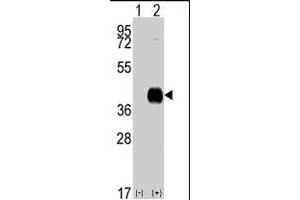 Western blot analysis of CAMK1 (arrow) using CAMK1 polyclonal antibody .