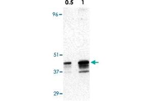 Western blot analysis of RRM2B expression in A-431 cell lysate with RRM2B polyclonal antibody  at 0. (RRM2B anticorps  (AA 2-17))