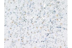 Phospho-MyoD1 (Ser200) Antibody at 1/100 staining Rat brain tissue by IHC-P.