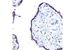 Immunohistochemistry of paraffin-embedded human esophageal using MLC3A Rabbit mAb (ABIN7268517) at dilution of 1:100 (40x lens).